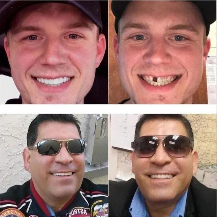 Confidence-Click Elite: Upper & Lower Set for Seamless Smile Restoration