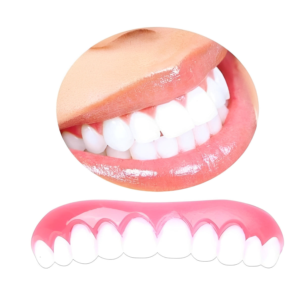 Flash-Grin Elite: Short-Term Artificial Tooth Covers for Seamless Smiles
