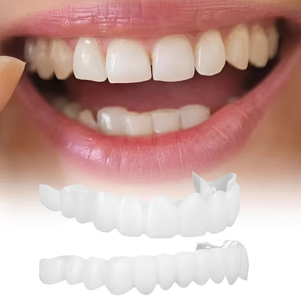 The Instant-Smile Pro: Snap-On Cosmetic Veneers for a Flawless Profile