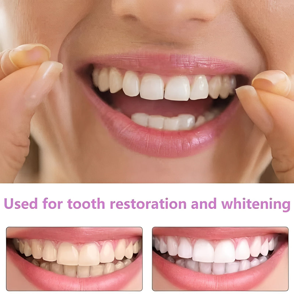 The Instant-Smile Pro: Snap-On Cosmetic Veneers for a Flawless Profile